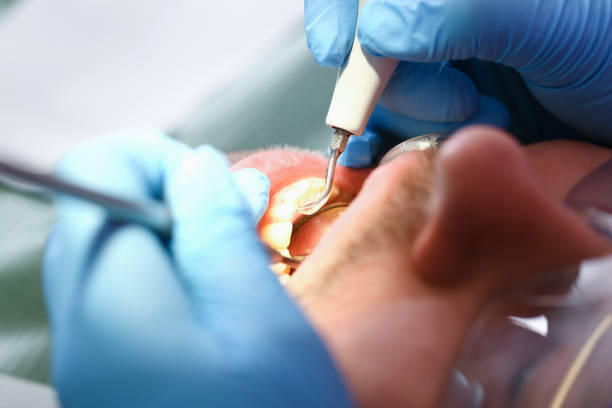 Best Dentist for Tooth Abscess  in Sulphur, OK