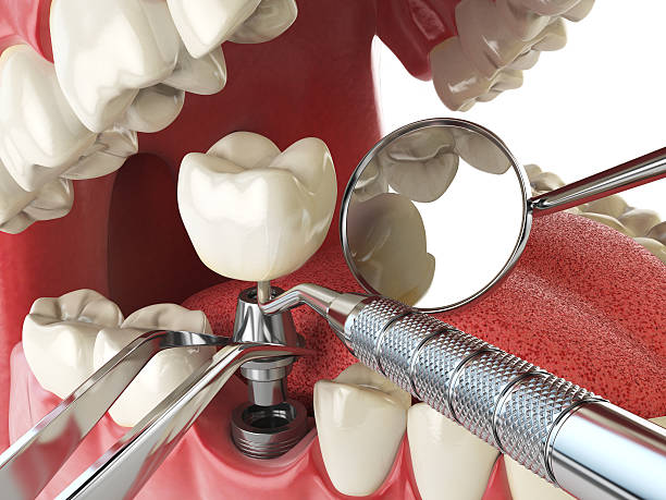 Best Teeth Whitening  in Sulphur, OK